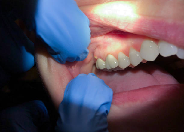 Best Weekend Emergency Dentist in Red Boiling Springs, TN