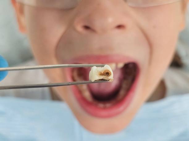Best Orthodontic Emergency Dentist in Red Boiling Springs, TN